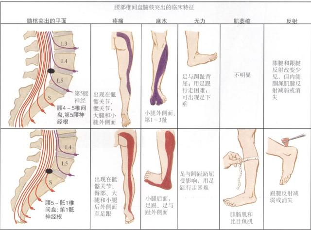 骨科医生推荐的睡姿，优化睡眠质量和身体健康的秘诀