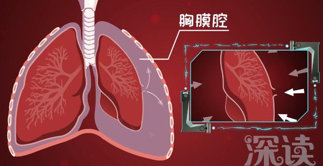 警惕气胸，三类人群需特别关注预防措施